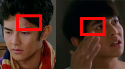 打在右額痛在左額